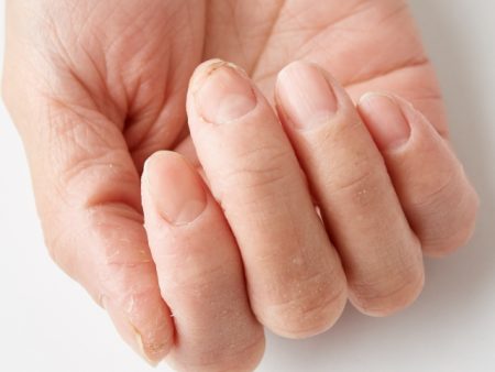 洗い過ぎも手荒れを引き起こす原因となります